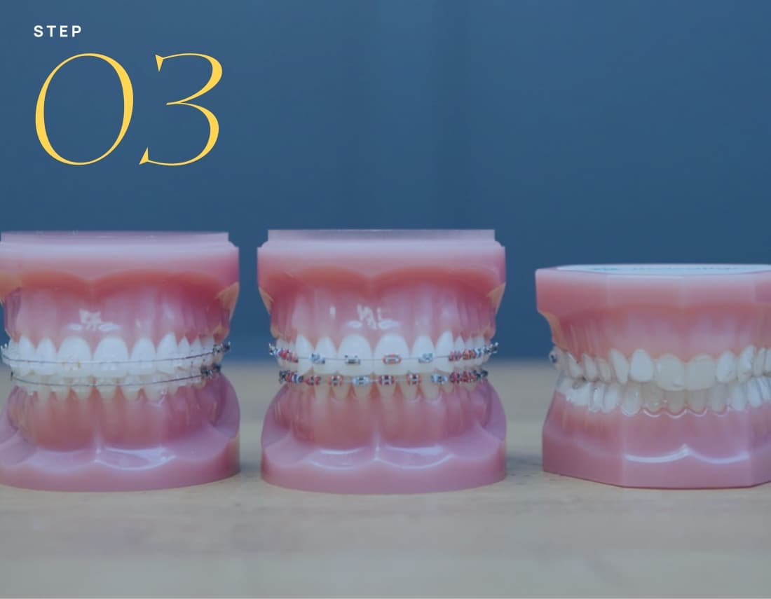 teen patient wearing new braces