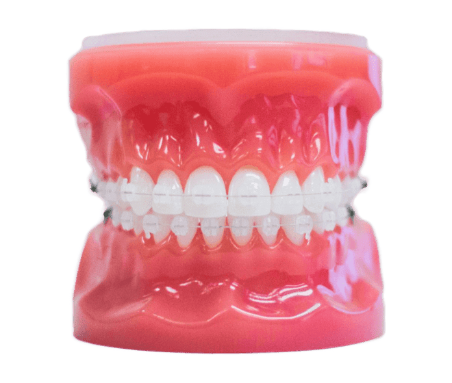 clear braces on plastic typodont model