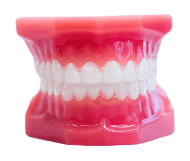 invisalign