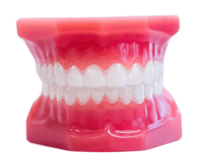 invisalign clear aligners on plastic typodont model