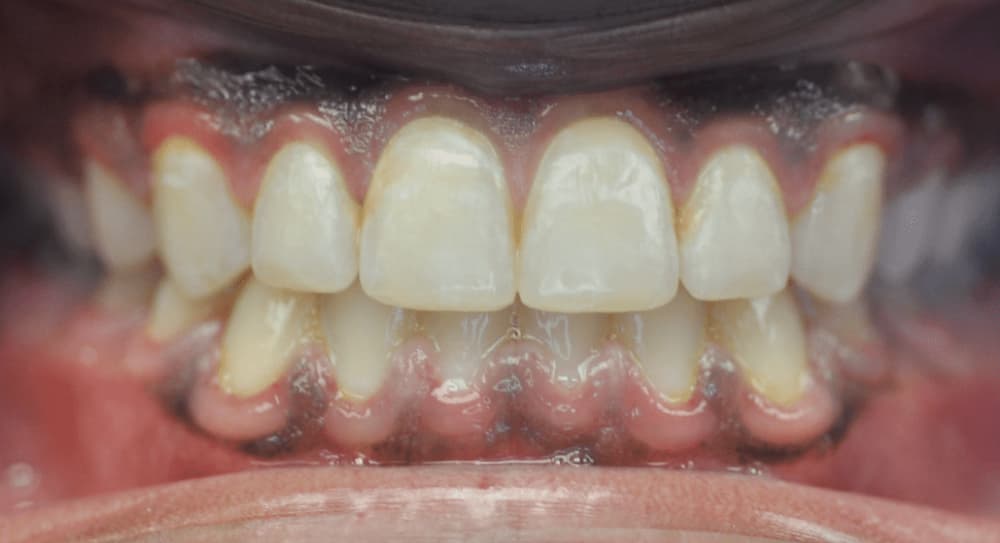after Image