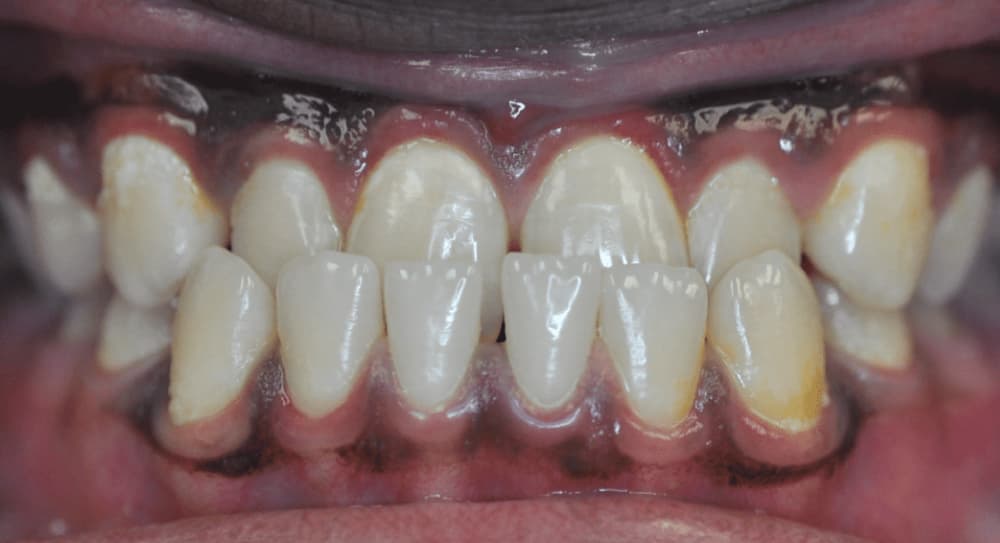 before Image