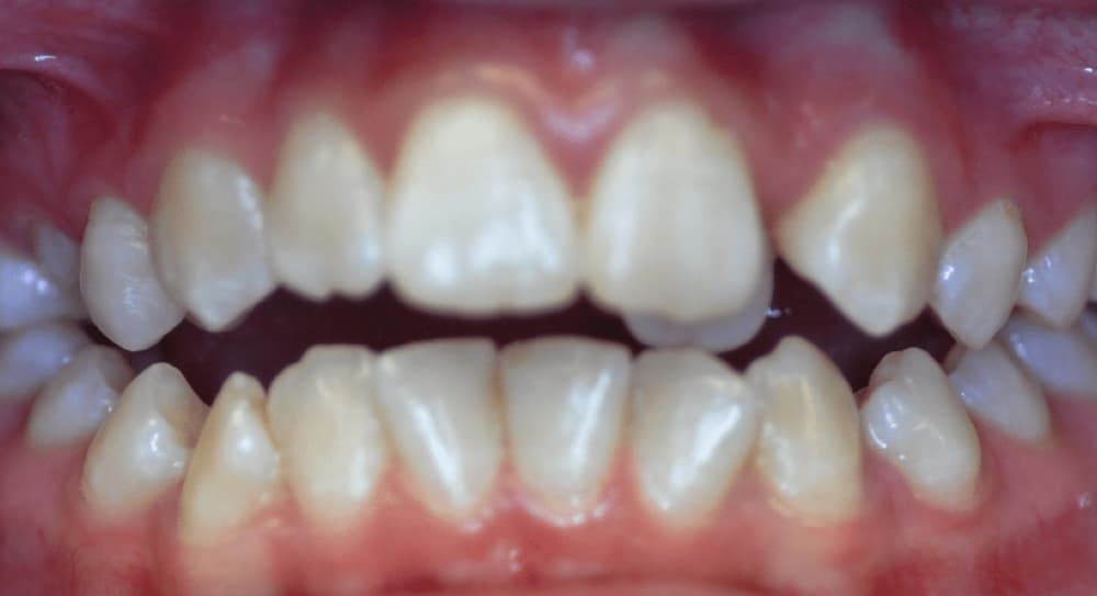 before Image