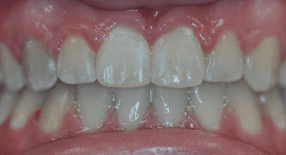 after Image