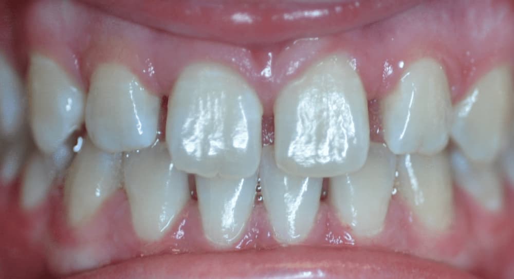 before Image