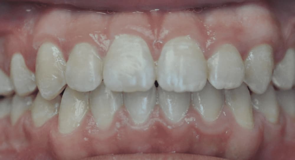 after Image