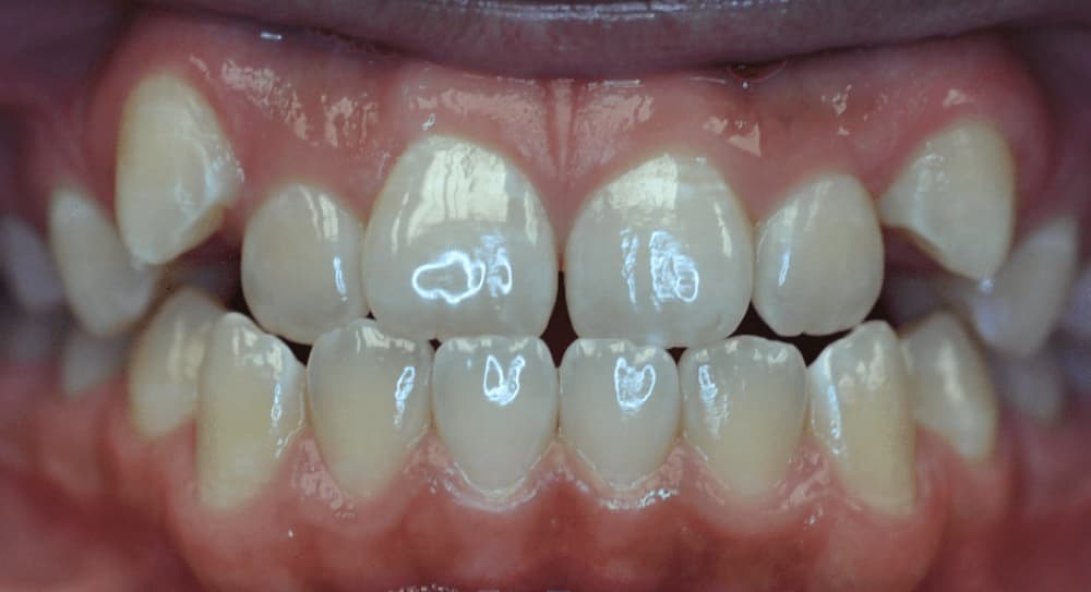 before Image
