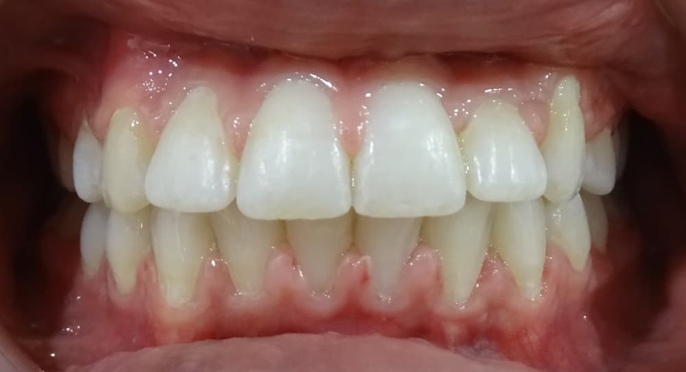 after Image