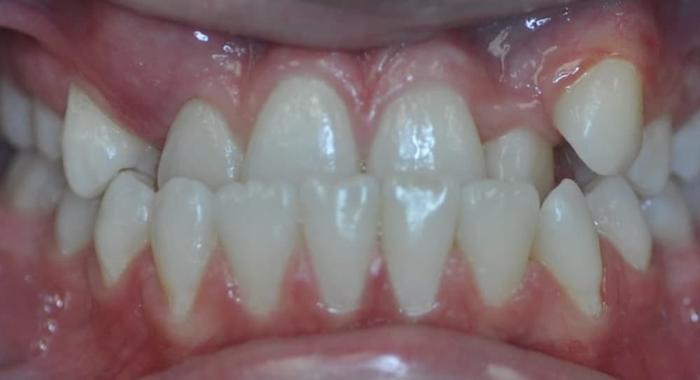 before Image