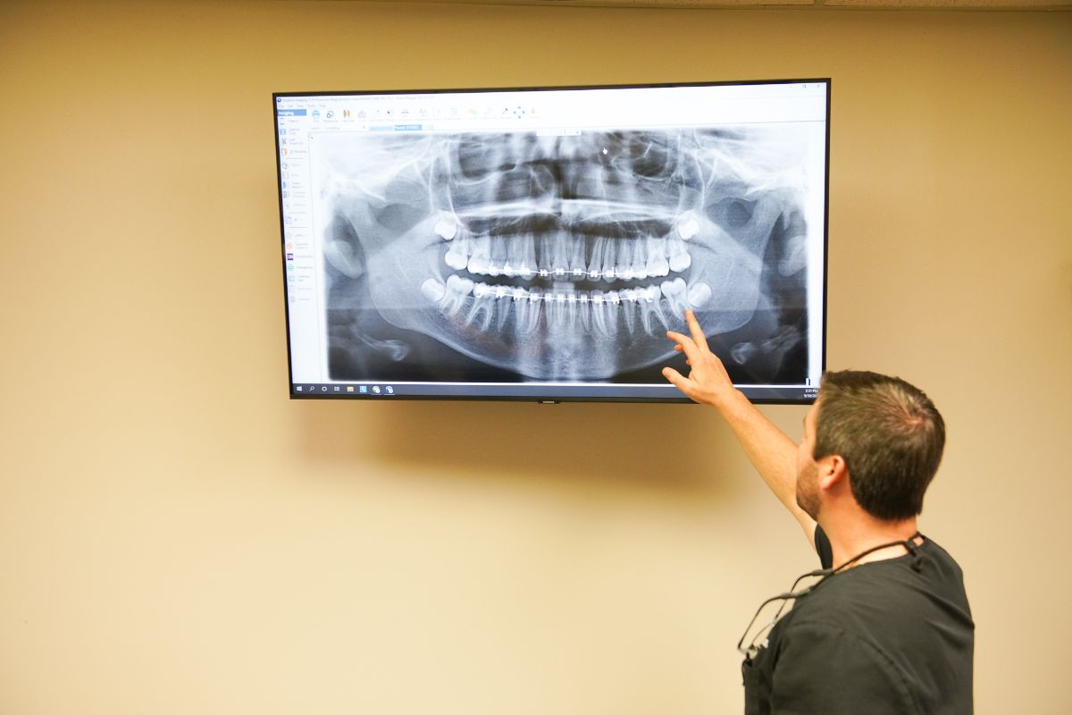 The Benefits of Orthodontics for Facial Asymmetry